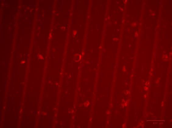 MDA-MB-175-VII cell adhesion to liqcreate bio-med clear