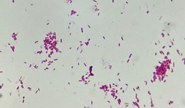 e. coli gramkleuring